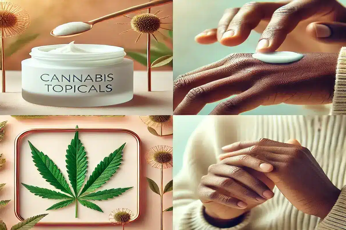 Cannabis Topicals for Eczema, Psoriasis, and Sensitive Skin: What You Need to Know